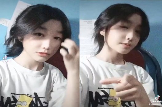 Non bị đồng nghiệp dụ dỗ để khoe bướu không lông